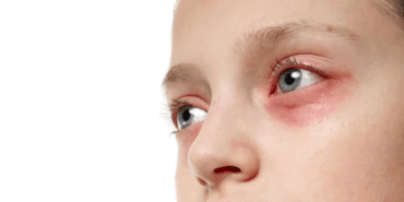 goz-alti-iltihabi-cocuklarda-dikkat